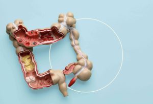 پاکسازی روده با طب سنتی و گیاهان دارویی