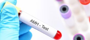 آزمایش AMH چیست و چه ارتباطی با بارداری دارد؟