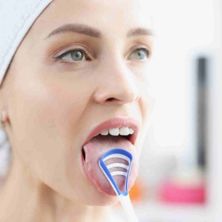 سفیدی روی زبان چیست و چگونه بوی بد دهان را کنترل کنیم؟