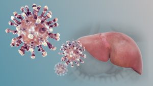 هپاتیت D یا دلتا؛ بیماری ویروسی خطرناک کبد که تنها در افراد مبتلا به هپاتیت B رخ می‌ دهد