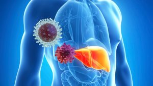 هپاتیت D؛ بیماری نادر اما پرخطر کبدی