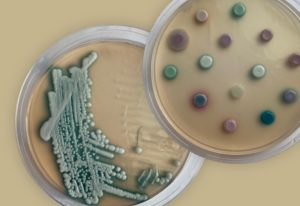 هشدار اروپا درباره قارچ مقاوم به دارو در بیمارستان‌ ها