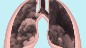 خطرناک‌ ترین ذرات آلاینده برای ریه‌ ها و سلامت تنفسی افراد