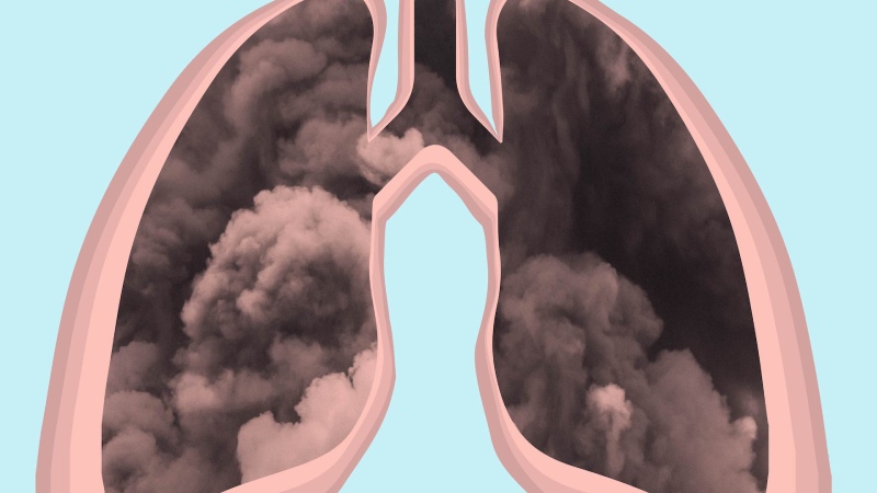 خطرناک‌ ترین ذرات آلاینده برای ریه‌ ها و سلامت تنفسی افراد