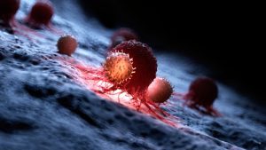 پیشرفت‌ های نوین جهان در پیشگیری و درمان سرطان؛ امیدی برای آینده