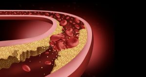 راهکارهای طبیعی کاهش کلسترول خون: تغذیه و سبک زندگی سالم