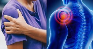 شانه یخ‌ زده چیست؟ علل، علائم و روش‌ های درمان