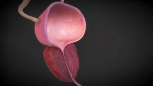 علائم خاموش بیماری‌ های پروستات و راهکارهای تشخیص و درمان آنها