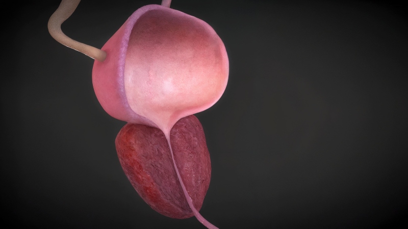 علائم خاموش بیماری‌ های پروستات و راهکارهای تشخیص و درمان آنها