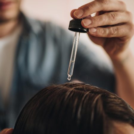 پروکاپیل یا ماینوکسیدیل: مقایسه کامل برای درمان ریزش مو