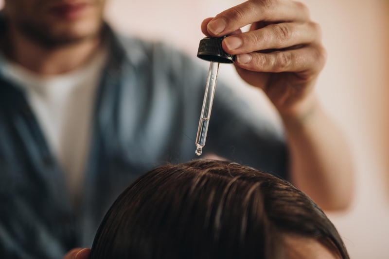 پروکاپیل یا ماینوکسیدیل: مقایسه کامل برای درمان ریزش مو