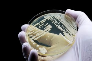 هشدار جهانی درباره قارچ مرگبار مقاوم به دارو: کاندیدا اوریس