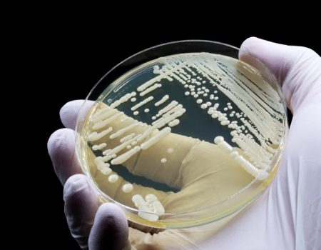 هشدار جهانی درباره قارچ مرگبار مقاوم به دارو: کاندیدا اوریس