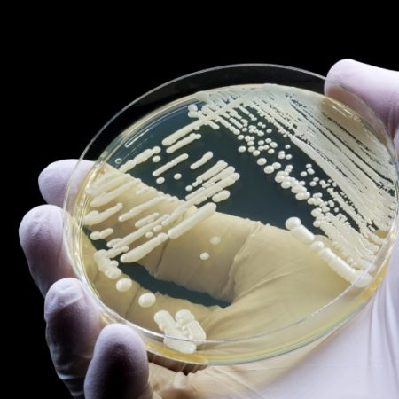 هشدار جهانی درباره قارچ مرگبار مقاوم به دارو: کاندیدا اوریس