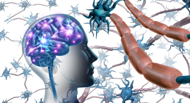 کشف دو زیرنوع جدید بیماری ام‌ اس توسط دانشمند ایرانی با کمک هوش مصنوعی