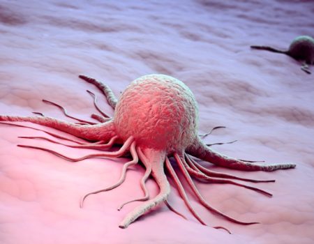 گزارش جهانی سرطان: بیش از یک‌ سوم موارد ابتلا قابل پیشگیری است