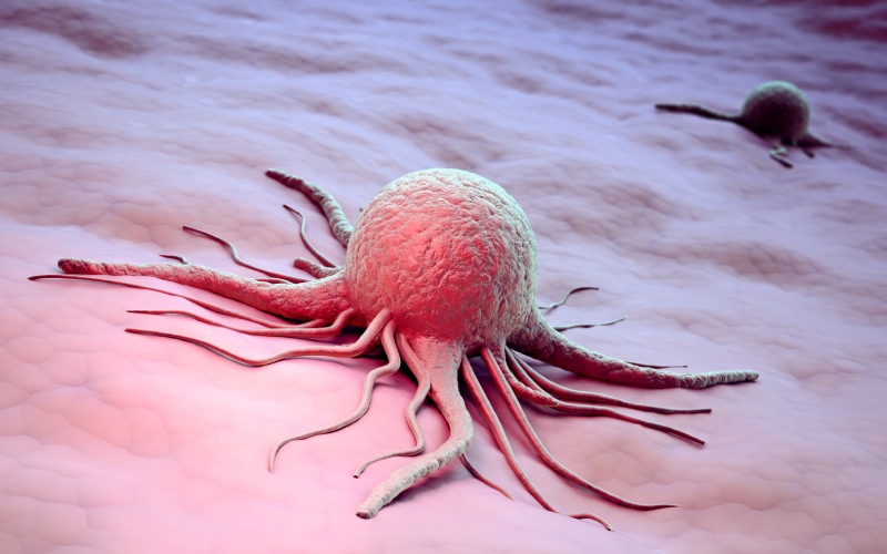 گزارش جهانی سرطان: بیش از یک‌ سوم موارد ابتلا قابل پیشگیری است