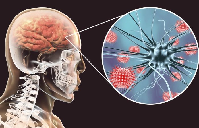 التهاب مغز چگونه خطر افسردگی و اضطراب مزمن را افزایش می دهد؟