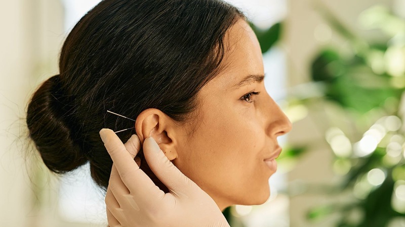 طب سوزنی گوش تا چه اندازه درد میگرن را کاهش داد؟