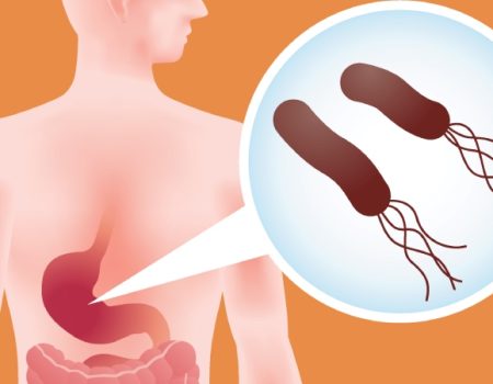 هلیکوباکتر پیلوری چگونه خطر سرطان معده را افزایش می دهد؟